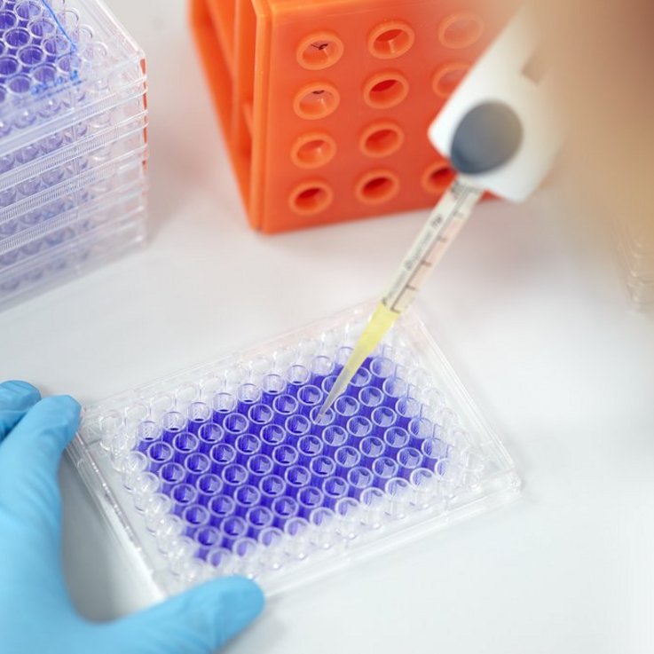 Application of the sample extract on nutrient solution with fibroblasts (connective tissue cells)